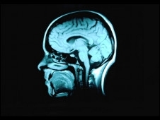 Testes medem nveis de ondas P300 no crebro da pessoa
