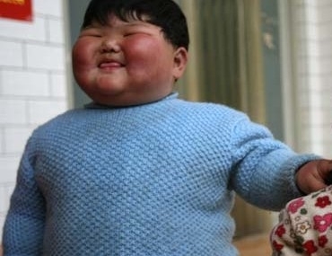Chinesa de 2 anos engorda demais, espanta mdicos e preocupa famlia
