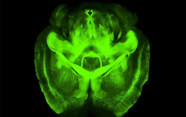 A tcnica desenvolvida por cientistas permite enxergar atravs do crebro sem que o rgo seja cortado
