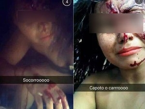 Selfies feitas aps acidente viralizaram na internet