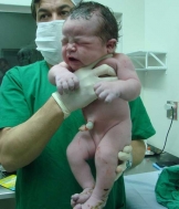 Beb� com mais de meio metro e 5,2 kg nasce em Uberl�ndia, MG