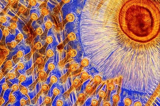 Concurso Wellcome Image Awards premia imagens feitas por mdicos e cientistas; na foto, perna de um besouro