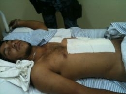 Rafael  um dos assaltantes da lotrica. Ele foi baleado na fuga quando trocou tiros com a Fora Ttica