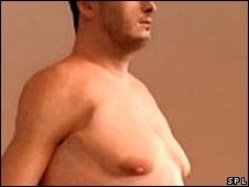 Houve um aumento de 28% das cirurgias na Gr-Bretanha