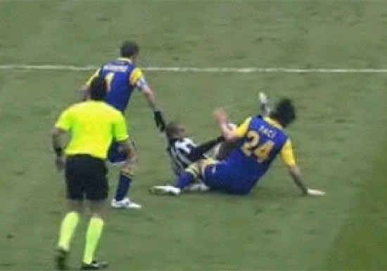 Juiz v de perto Felipe Melo acertar a cabea do jogador Paci, do Parma