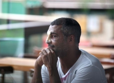 Romrio aparece em shopping com olhos roxos e nariz inchado