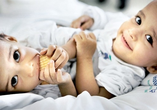 As siamesas Keroly e Kauany, de 10 meses, antes da cirurgia