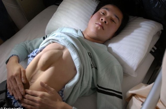 Rapaz de 24 anos corria risco de morte se no fizesse operao.