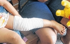 Crian�a foi encaminhada � policl�nica e recebeu atendimento; m�e da menor prestou queixa � Pol�cia  