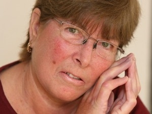 Por causa da doena, Susan Johnson tem fortes dores e inchao nas juntas.