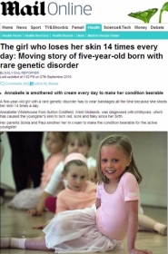 Annabelle Whitehouse leva uma vida normal, embora tenha de passar cremes e trocar bandagens com frequncia