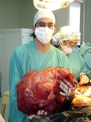 Tumor tinha 23 kg