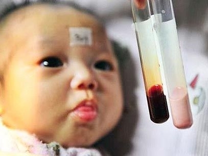 A cor anmala do sangue da pequena  causada por uma doena chamada hiperlipidemia, que  o excesso de substncias gordu