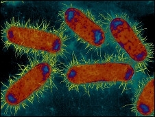 Bactria como a E.Coli (foto) podem ter o gene NDM-1
