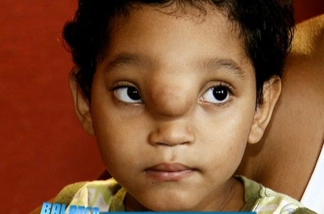 Me pede ajuda para custear a cirurgia do menino