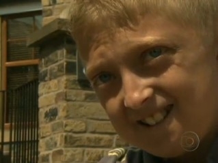 Criana inglesa tem doena rara que o faz envelhecer rapidamente