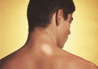 Mdico destaca que paciente deve procurar um PSF, que faz avaliao mais aprofundada 