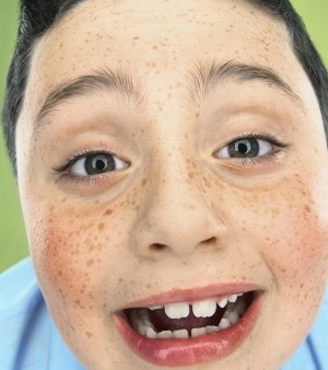 Tapa no testculo dos outros  refresco