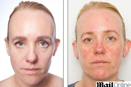 Anna envelheceu dez anos em um ms por no lavar o rosto