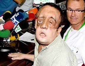 Rafael j� tem sensibilidade � dor e diferencia o calor e o frio