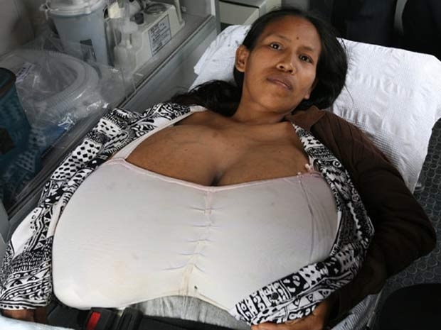 Manihuari viu seus peitos crescerem depois de ter o terceiro filho.