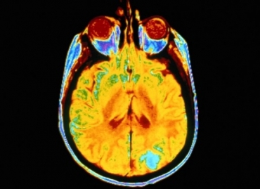 C�rebro de mulheres saud�veis ativa a identidade e a autorreflex�o quando veem imagens de mulheres gordas