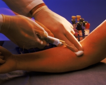 Estudo defende vacinar meninos contra HPV