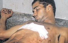 Depois de receber atendimento no Pronto-Socorro Alessandro de Souza 