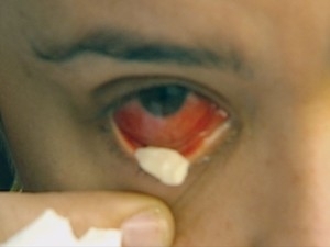 Professora conta que j passou por mais de 30 mdicos 