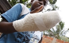 Paulo do Nascimento levou um tiro na mo e o av dele foi atingido no abdome; criminoso estaria tentando acertar vizinho