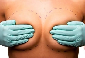 Travesti morreu ao aplicar cinco litros de silicone industrial