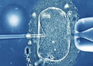 Estudo pode ajudar pacientes a decidir se congelam vulos