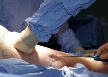 Jornalista morre ap�s lipoaspira��o em Bras�lia