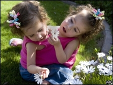 Emma e Taylor Bailey dividem um corao com sete cmaras.