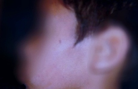 Tapa da professora teria deixado marca na bochecha do estudante