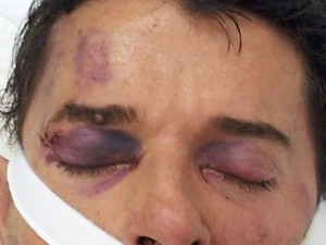 Luiz Antnio est internado em estado grave