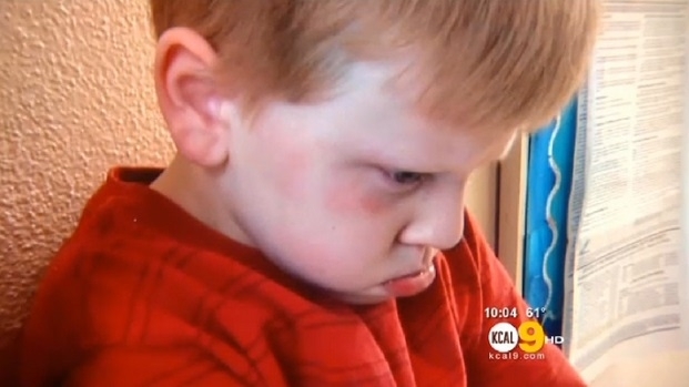 Professora segurou a cabea do aluno com uma mo e deu um forte tapa no rosto da criana, segundo jornal