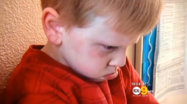 Professora segurou a cabea do aluno com uma mo e deu um forte tapa no rosto da criana, segundo jornal