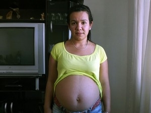 Gislaine sofre com cisto h cerca de um ano.