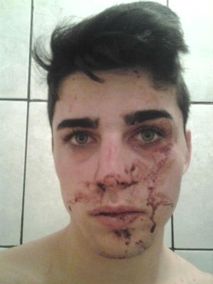 Maisson Dydimes Portes, de 19 anos, contou que  bissexual e que os rapazes o agrediram por esse motivo