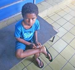 Marcondes do Carmo Pereira da Silva, 9 anos, tem um desvio no p e aguarda uma cirurgia no PS