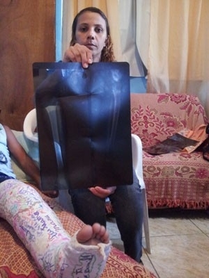 Me de menino mostra exame: menino sofreu duas fraturas