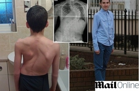 Garoto cresce aps cirurgia na Inglaterra