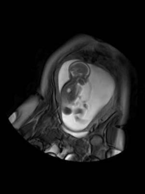 Beb ainda no tero da me