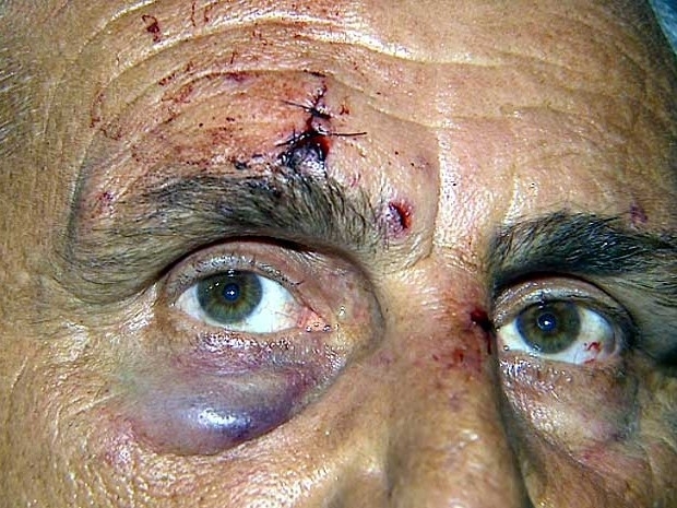 O motorista Josimar da Silva que foi agredido por assaltantes em Hortol�ndia