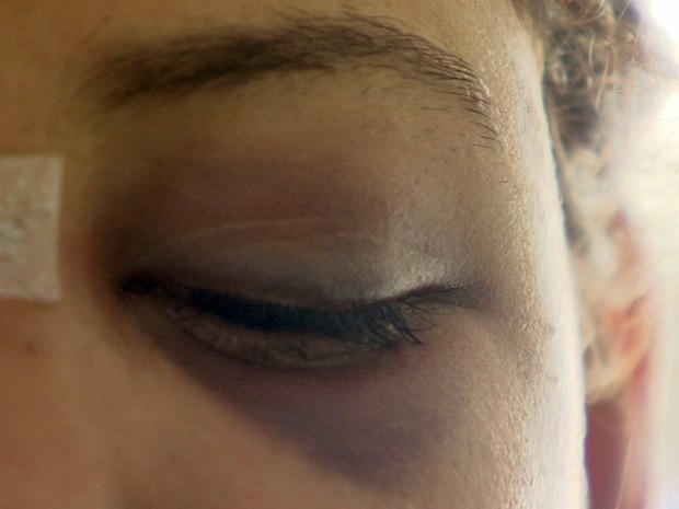 Jovem foi espancada por ex-namorado em So Vicente, SP.