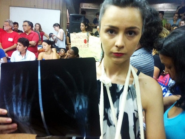 Estudante teve um osso das m�os fraturado