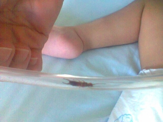 Inseto foi encontrado em tubo de oxignio de criana no interior de SP