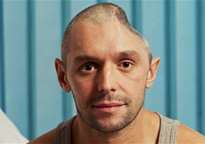 Britnico teve 1/4 do crnio removido aps cair de varanda de hotel na Tailndia