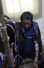  Sem dinheiro para ir ao hospital, Hu Songwen desenvolveu sua prpria mquina de hemodilise